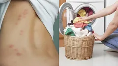 Du tvättar kläderna fel: Vid vilken temperatur dör egentligen dammkvalster?